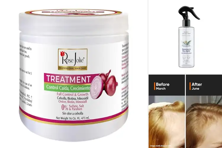 Detailed view of Best Hair Fall Control Treatments